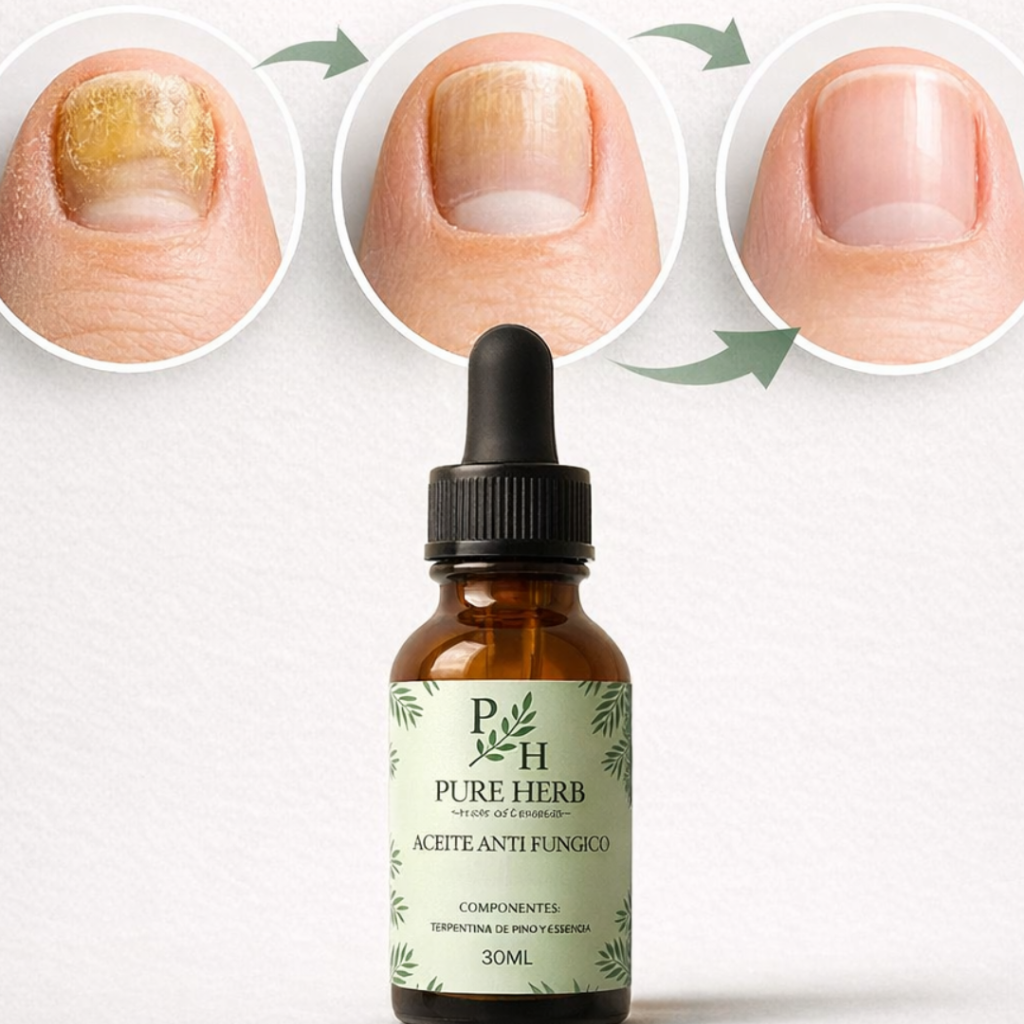Aceite Antihongos Pure Herb para pies y u&ntilde;as